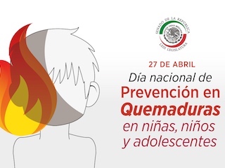 bnal-QUEMADURAS NINOS-WEB