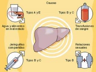 sal3-hepatitis-causas-web