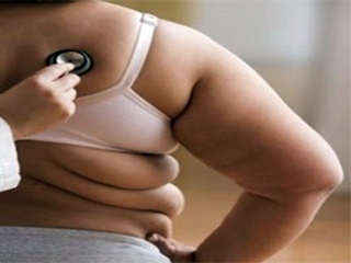 salud3-obesidad