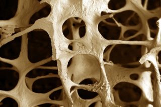 salud1-osteoporos