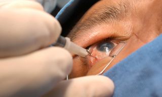 salud-glaucoma