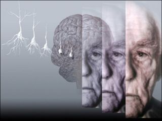 salud-Alzheimer