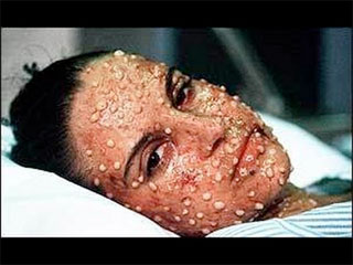 pol4-web