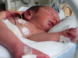 salud2-prematuros-web