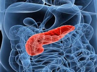 pancreatitis