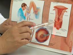 cervico