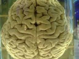 cerebro