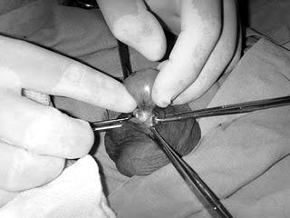 testicular
