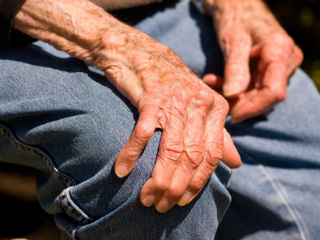 parkinson