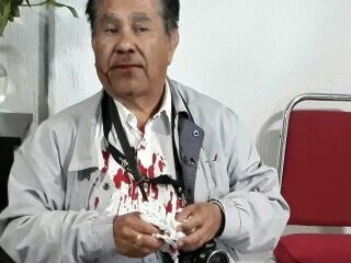 edomex-periodista-atacadoWEB