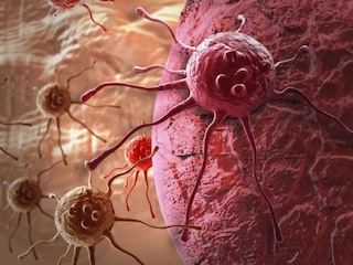 web-metastasis