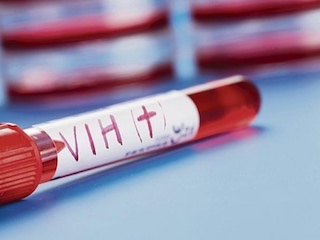 web-62-salud-vih