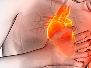 web-66 infarto-diabeticos