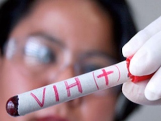 web-62-VIH-1