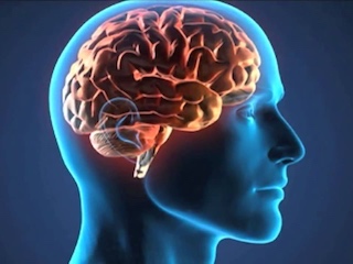 web-62-Enfermedad Vascular Cerebral