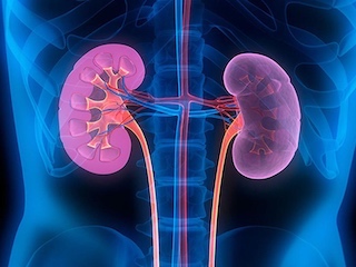 web-62-renal-cronica