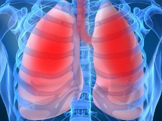 Mejoras en Cancer Pulmon